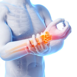 arthritis pain - Information About Arthritis Pain