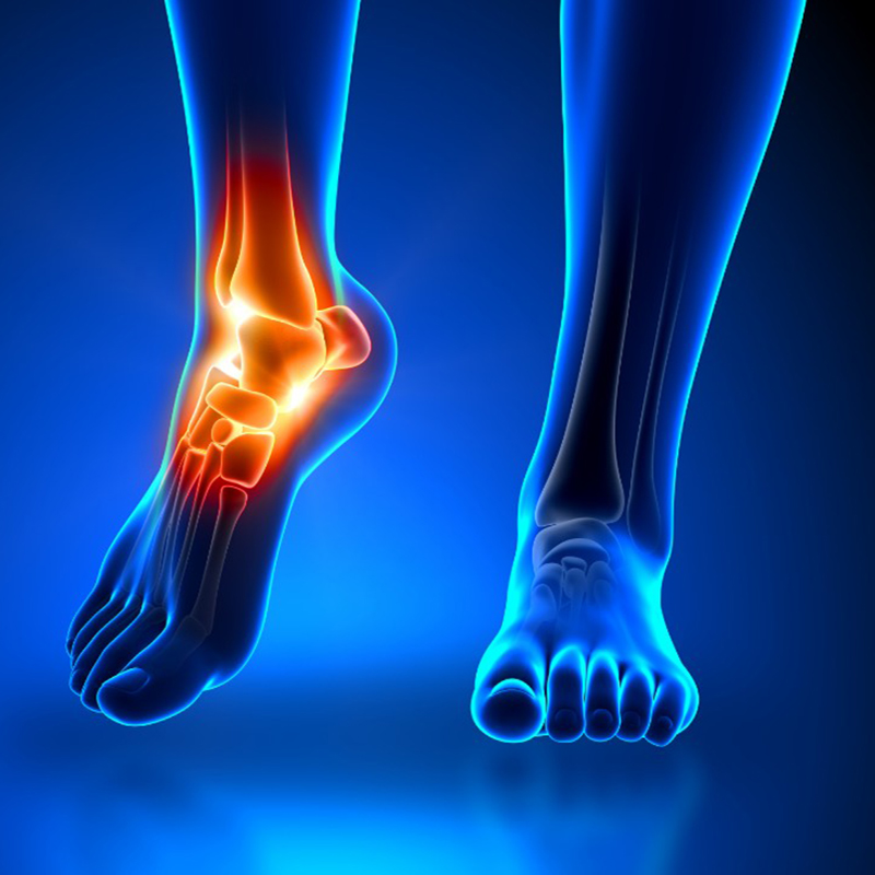 Foot Ankle Pain Relief - Conditions We Treat