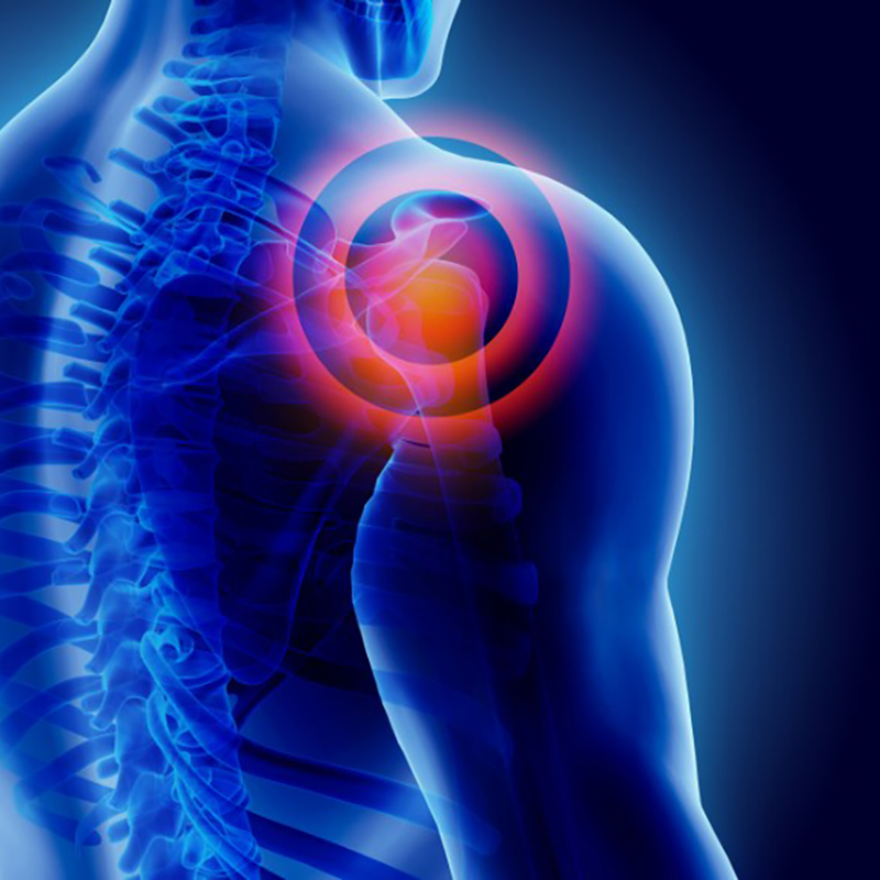 Shoulder Pain Management - Conditions We Treat