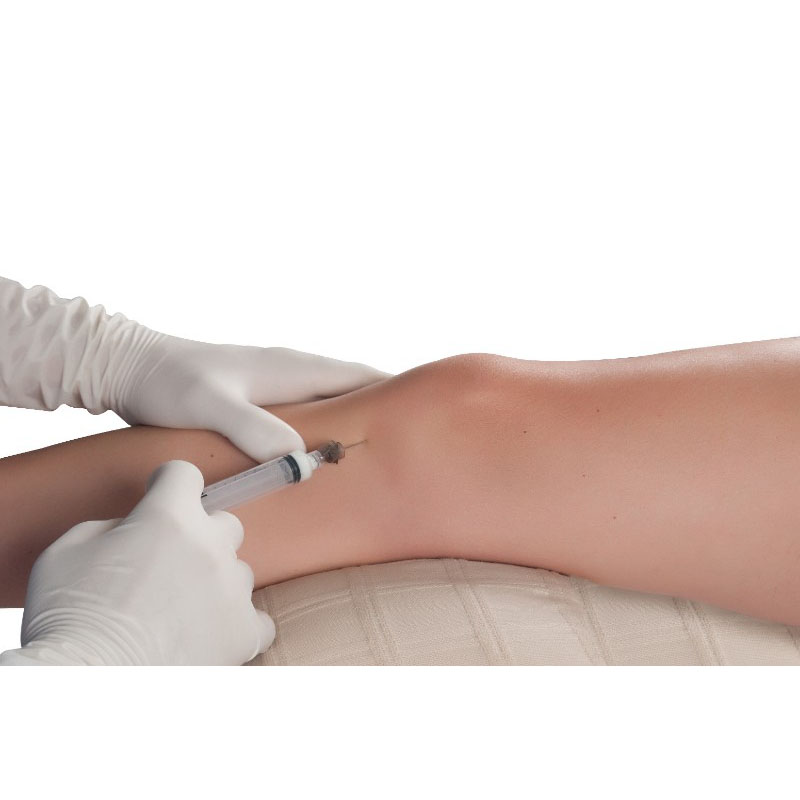 iStock 510693903 new - Knee Prolotherapy